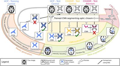 Deep Learning-Based Detection of Malformed Optic Chiasms From MRI Images